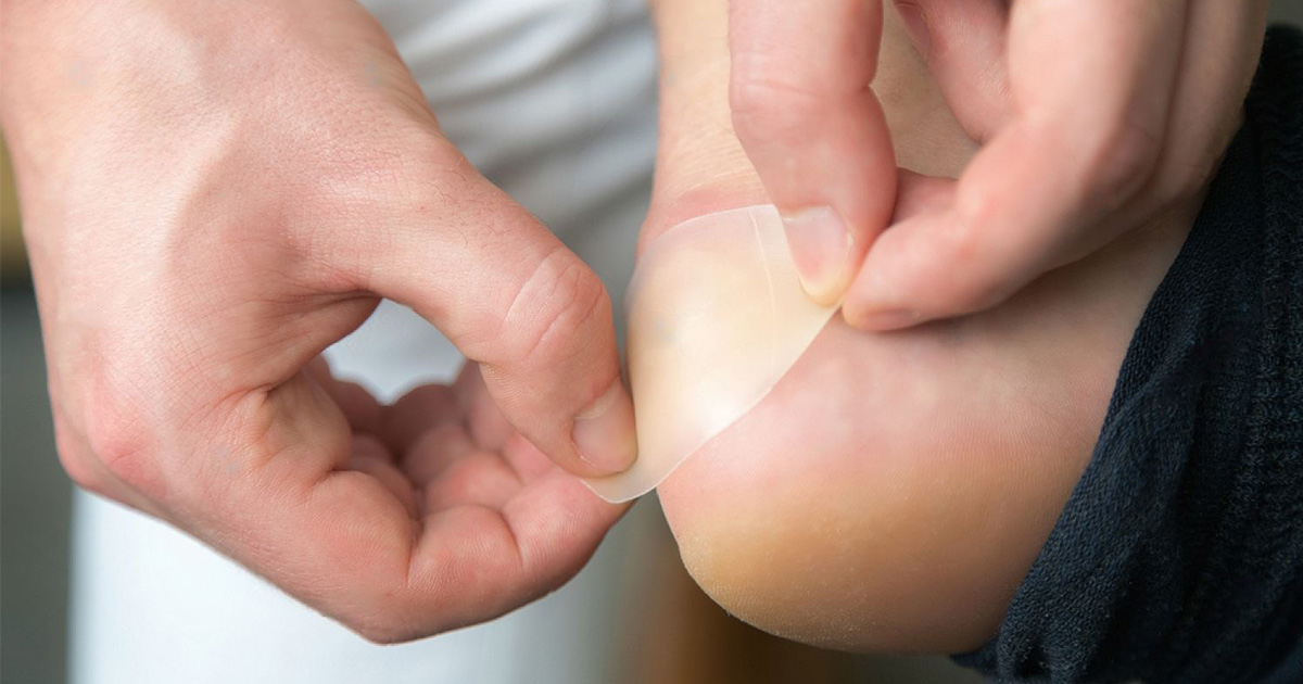 causes of foot blisters